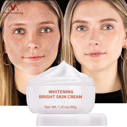 Potente crema blanqueadora para pecas